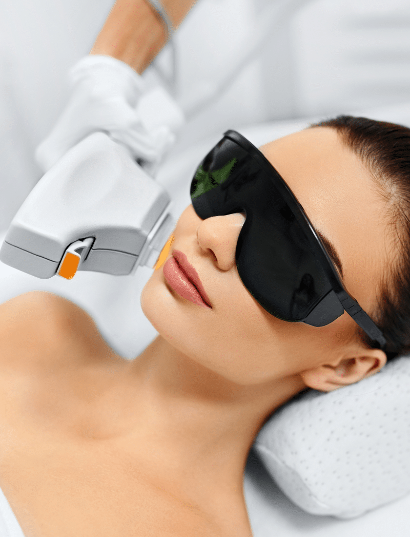 Treatment for Facial Hyperpigmentation 1