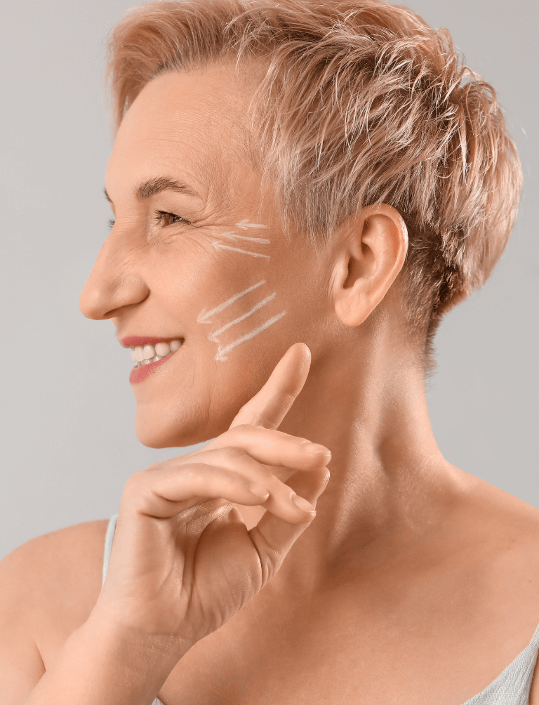 sculptra