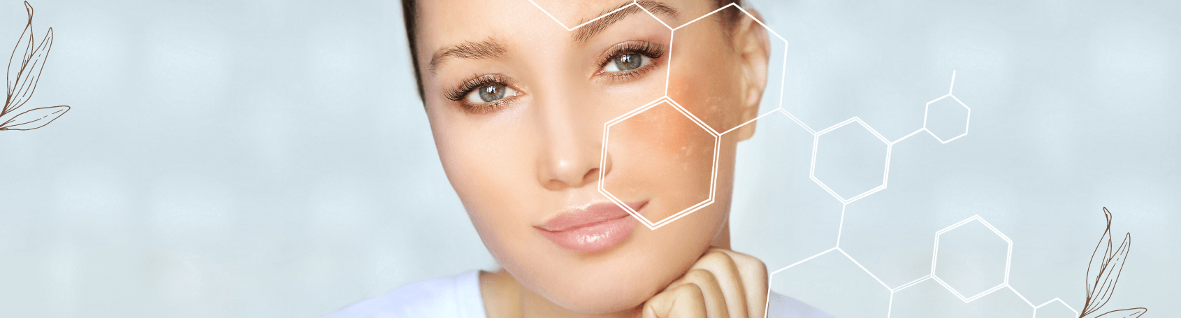 hyperpigmentation
