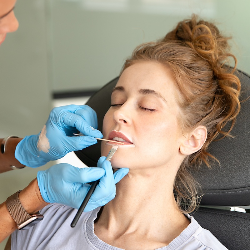 lip filler